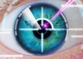 Laser Eye Surgery