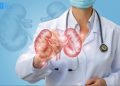Kidney Specialist Doctor