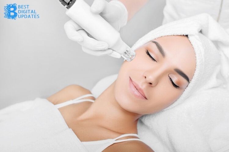 The Truth About Skin Needling: Why You Should Be Careful with The Hyped Procedure