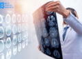 What Are The 4 Types Of Traumatic Brain Injuries?